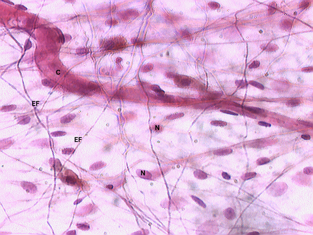 Connective Tissue & ECM
