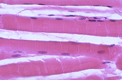 Cross-section of skeletal muscle showing polygonal fibres