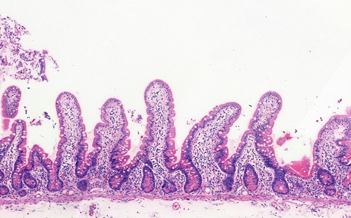 Small Intestine
