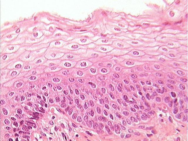 Stratified Epithelium